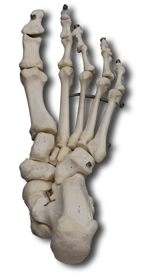 Plantar