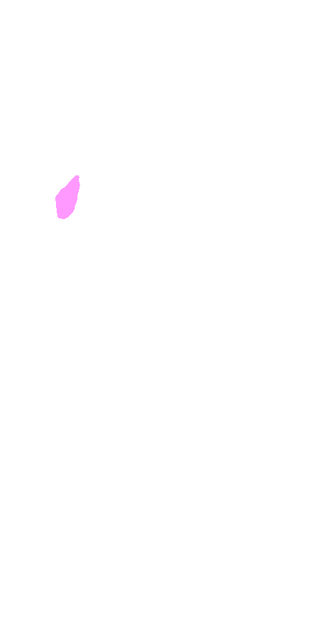 Gastrocnemius Lateral Head