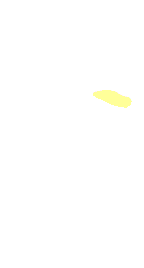 Rectus Femoris