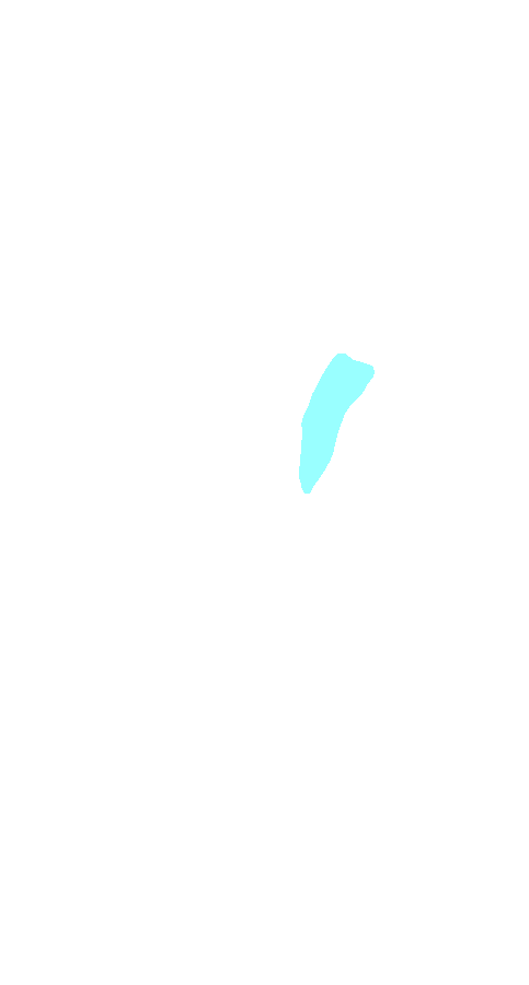Vastus Lateralis