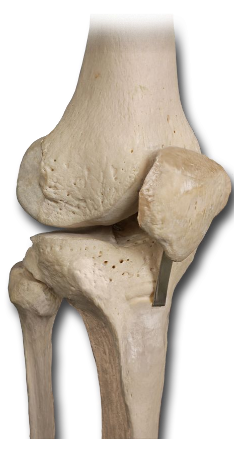 Anterior Knee
