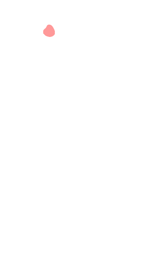 Gastrocnemius Lateral Head