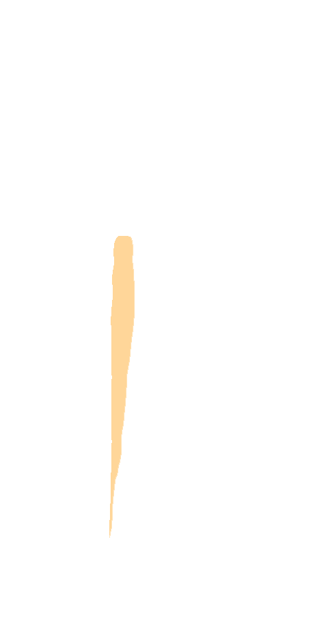 Tibialis Posterior