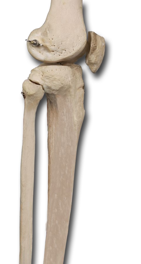 Lateral Knee