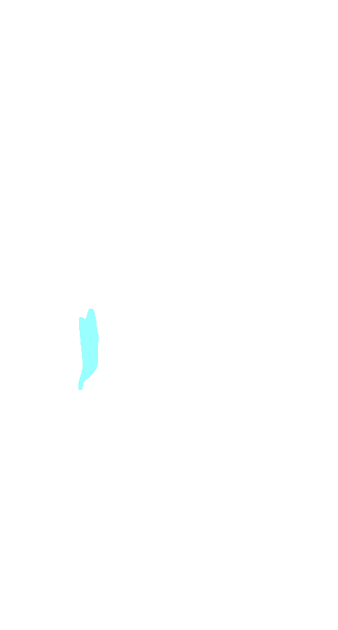 Patellar Ligament