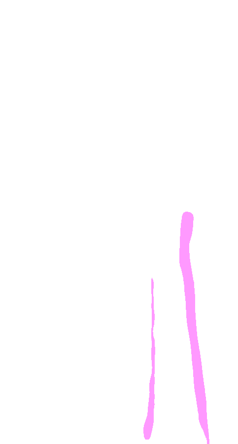 Soleus