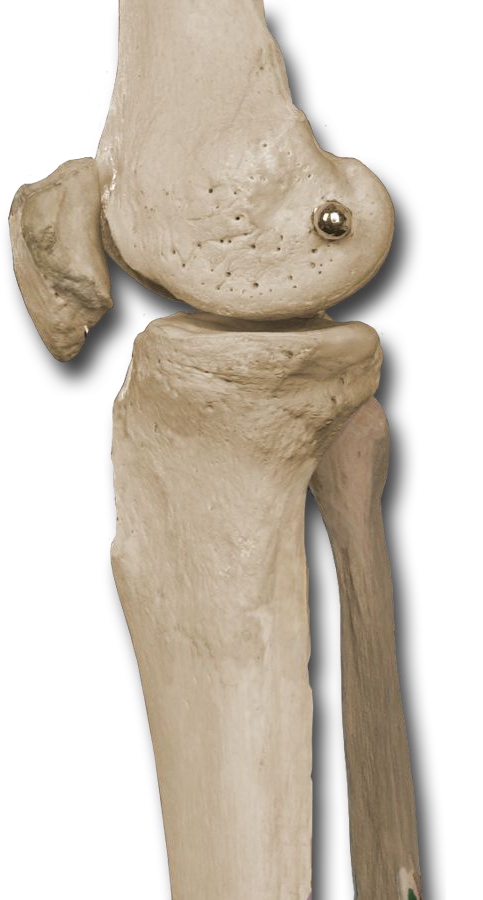 Medial Knee