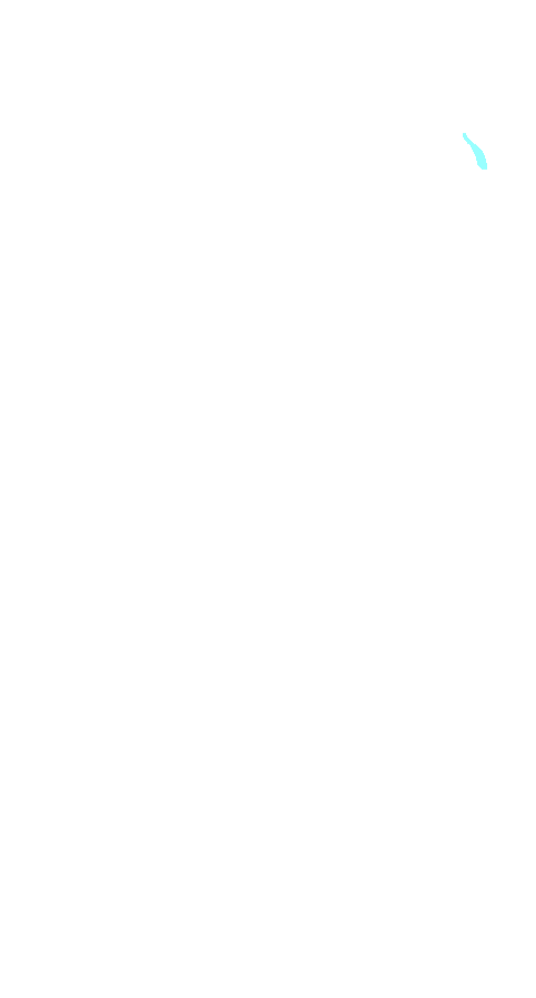 Gastrocnemius Lateral Head
