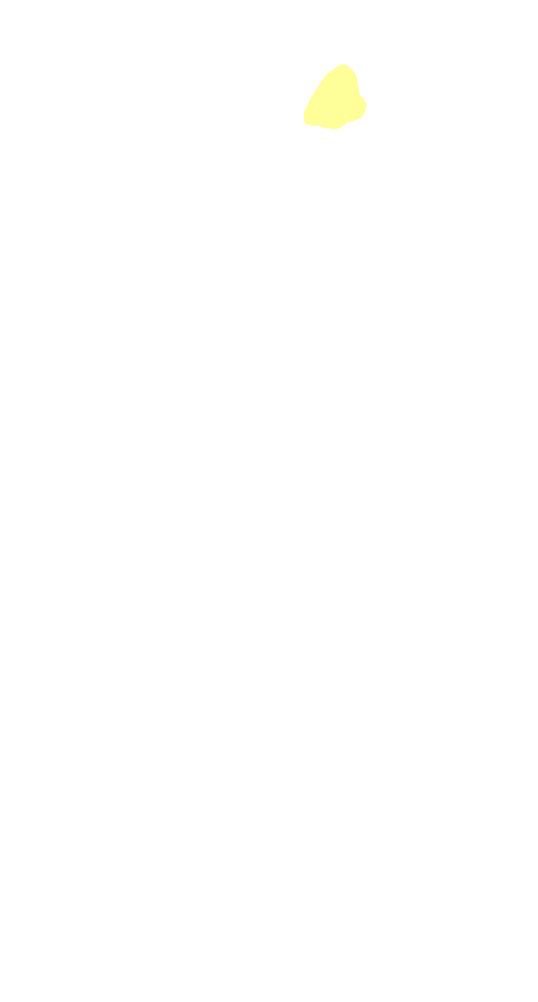 Gastrocnemius Medial Head