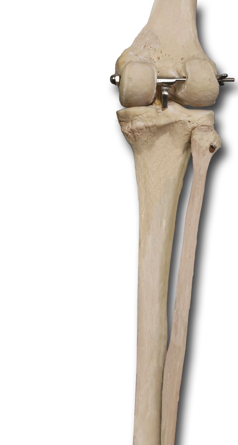 Posterior Knee
