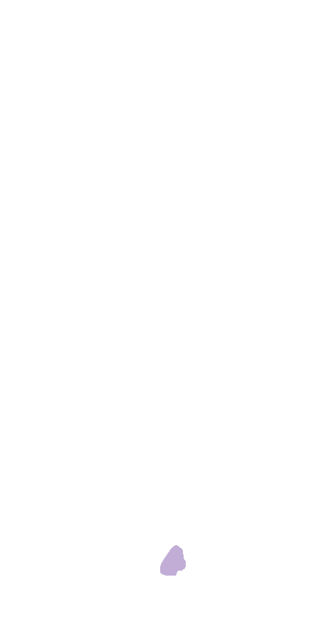 Gastrocnemius Medial Head