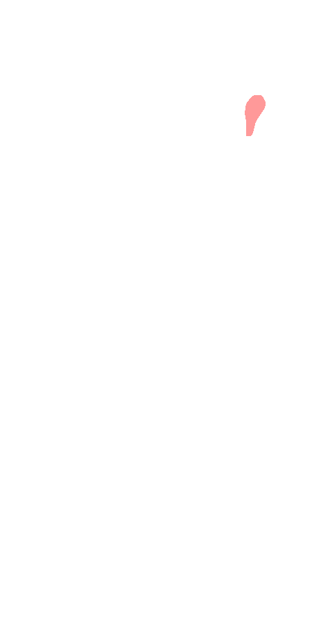 Quadratus Femoris
