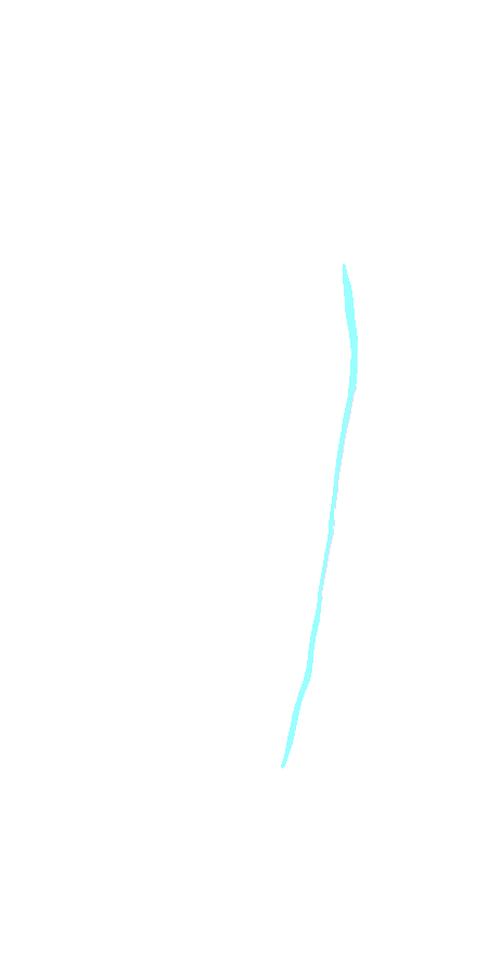 Vastus Medialis