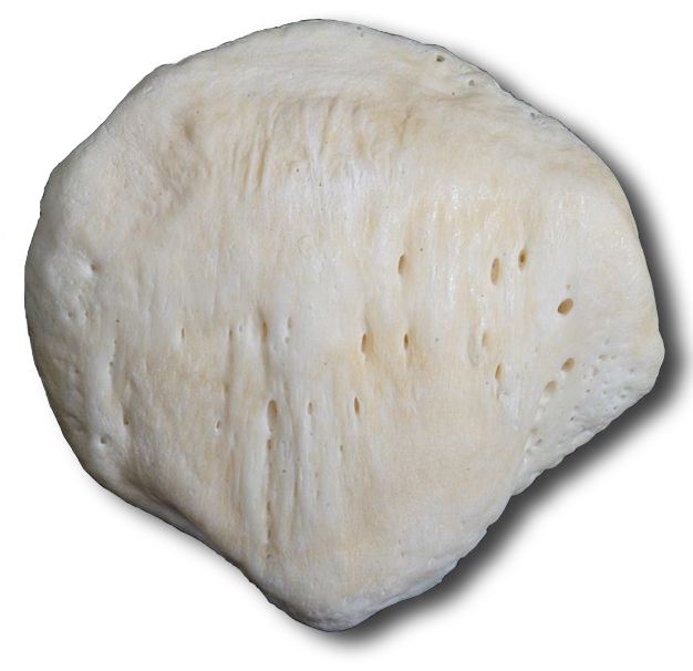 Anterior Patella