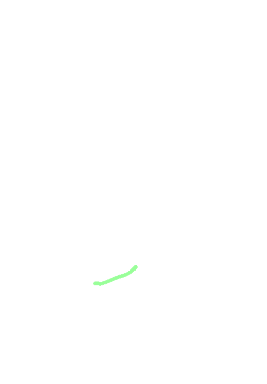 Acetabular Notch