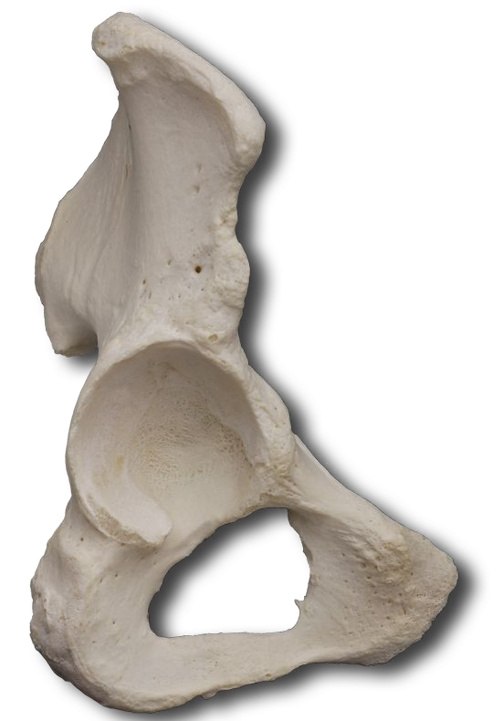 Anterior-Lateral Pubic