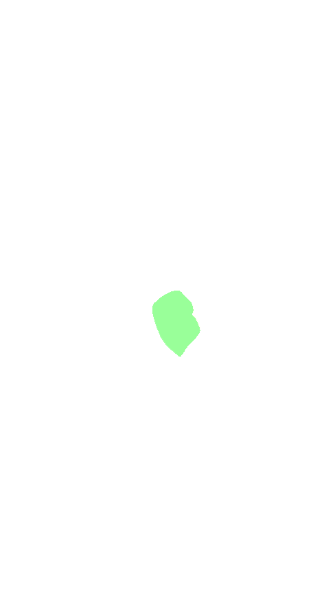 Lateral Cuneiform