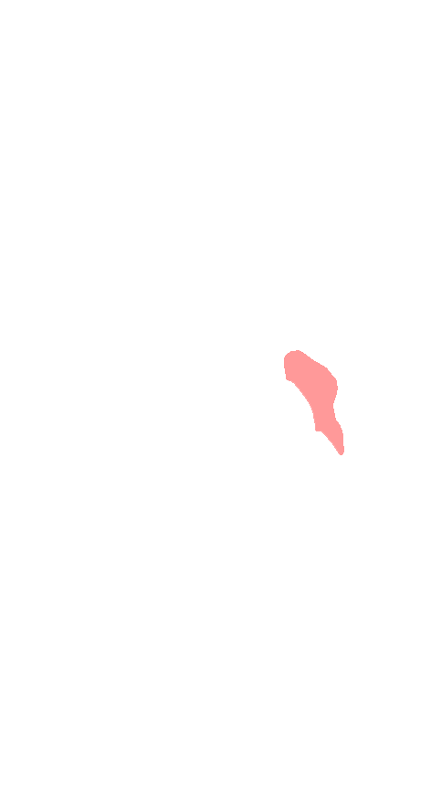 Medial Cuneiform