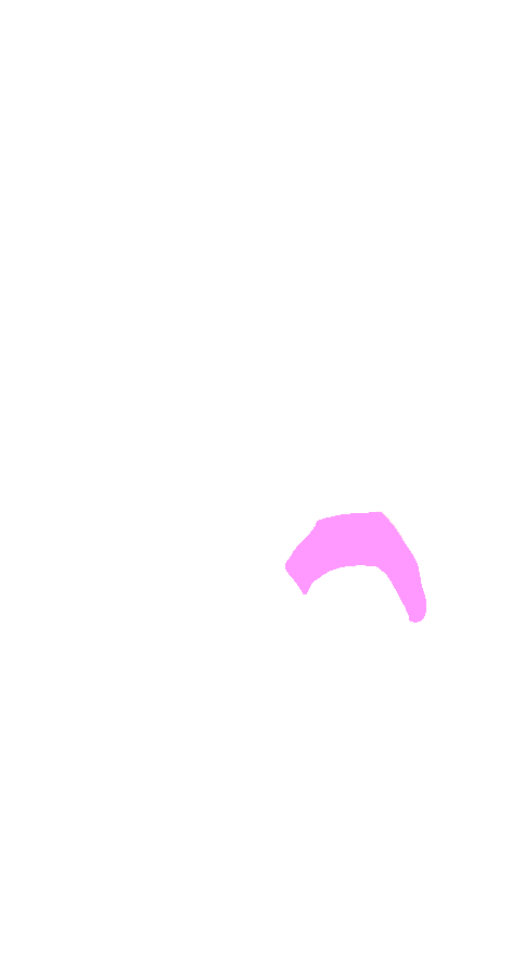 Navicular