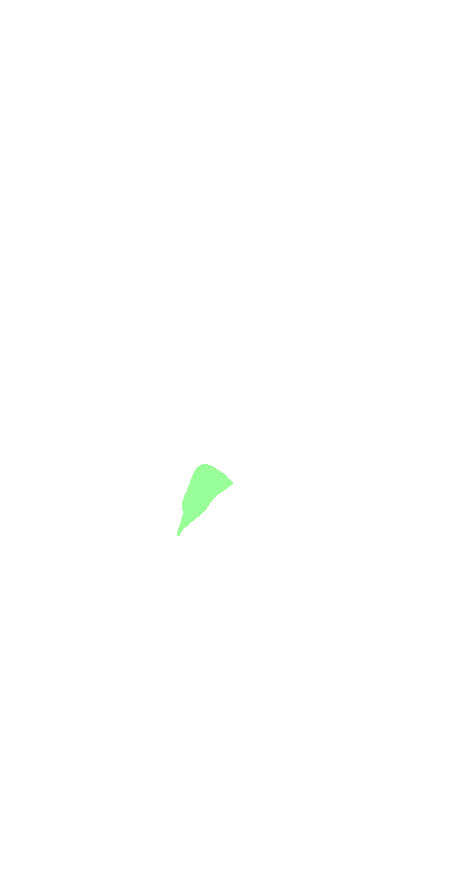 Lateral Cuneiform
