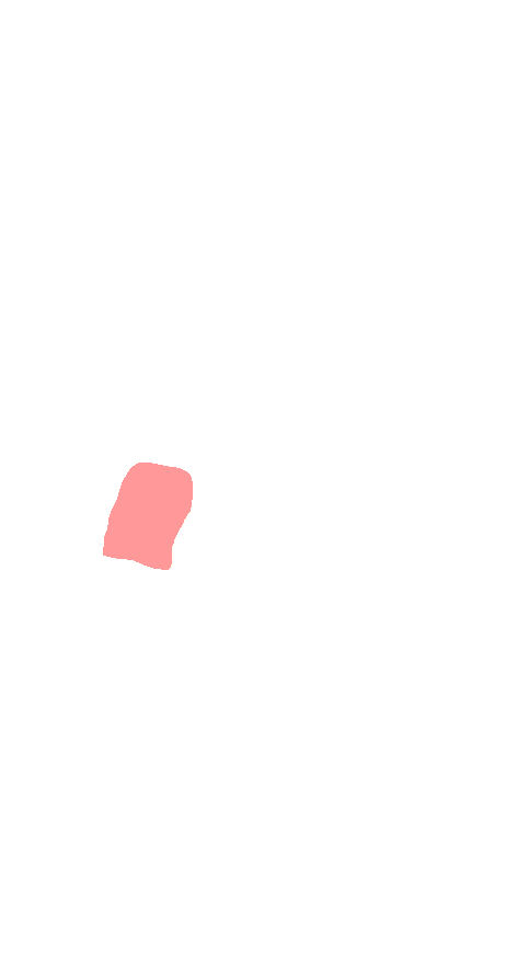 Medial Cuneiform