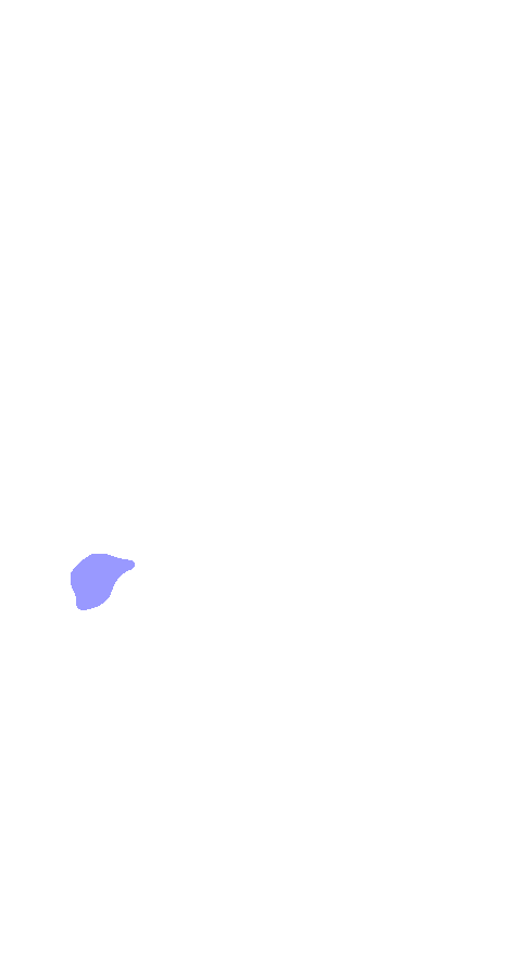 Tuberosity