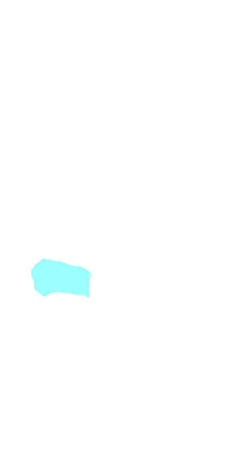 Navicular