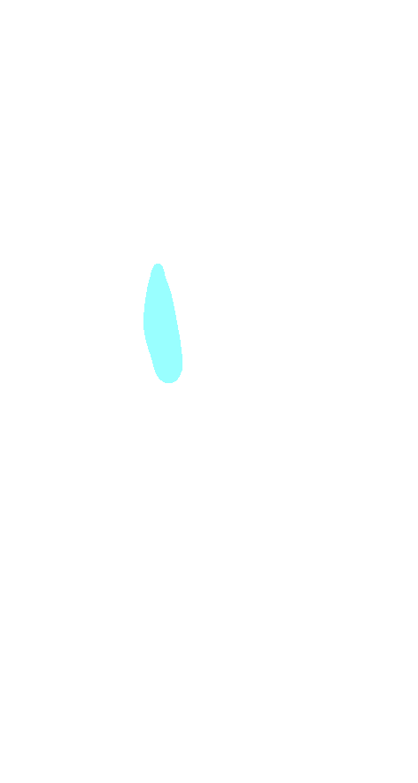 Lateral Facet