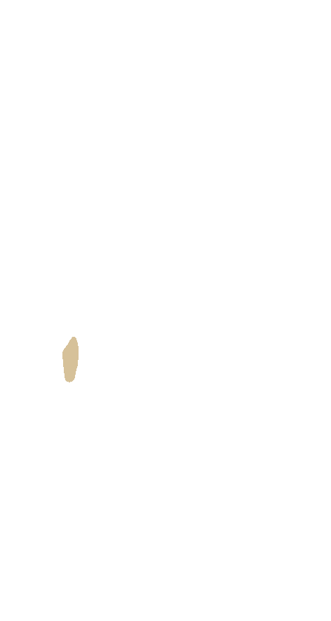 Peroneal Trochlea