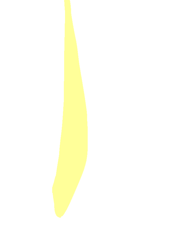 Lateral Surface