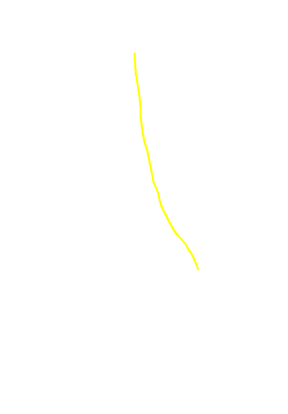 Medial Border