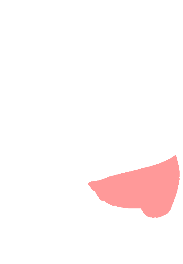 Medial Malleolus