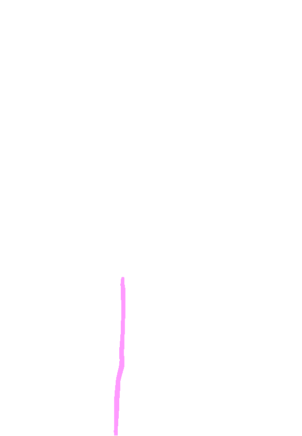 Anterior Border