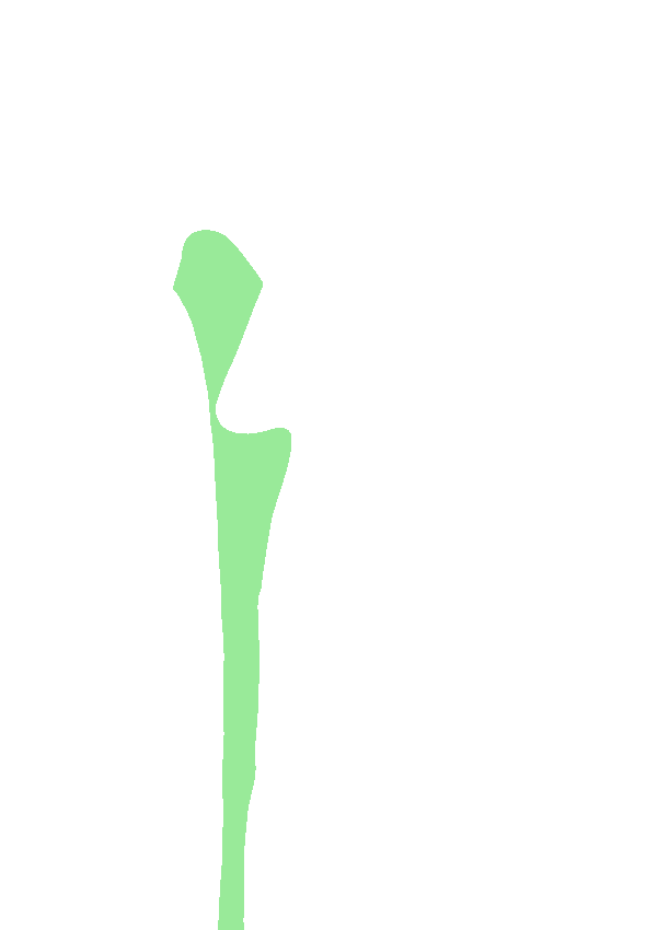 Lateral Surface