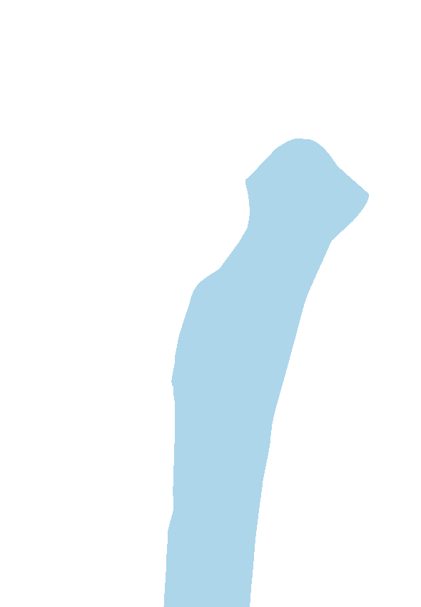 Medial Surface