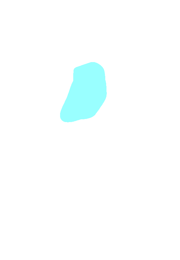 Tibial Tuberosity