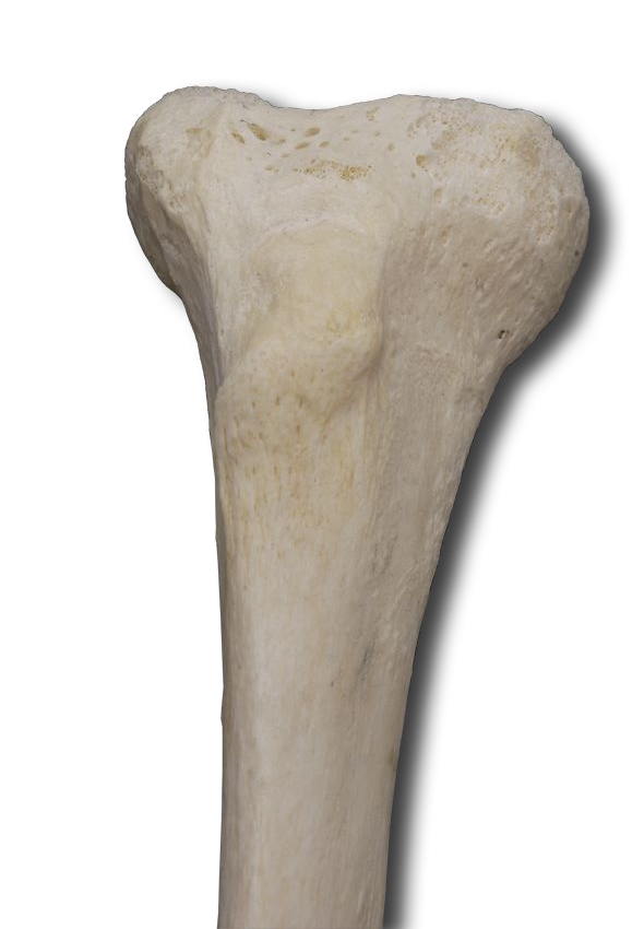 Proximal Anterior