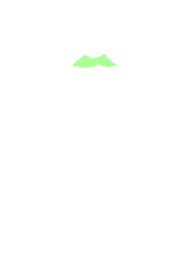 Intercondylar Eminence