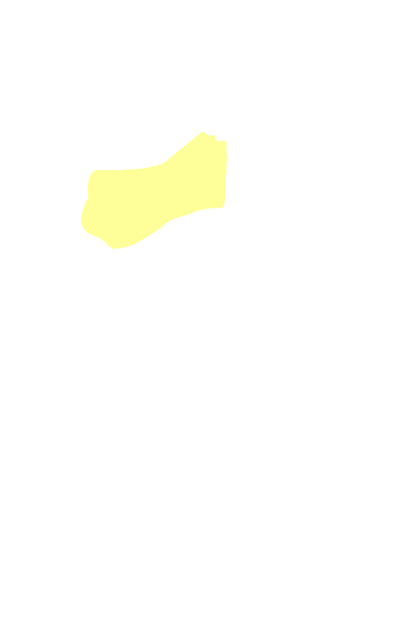 Lateral Condyle