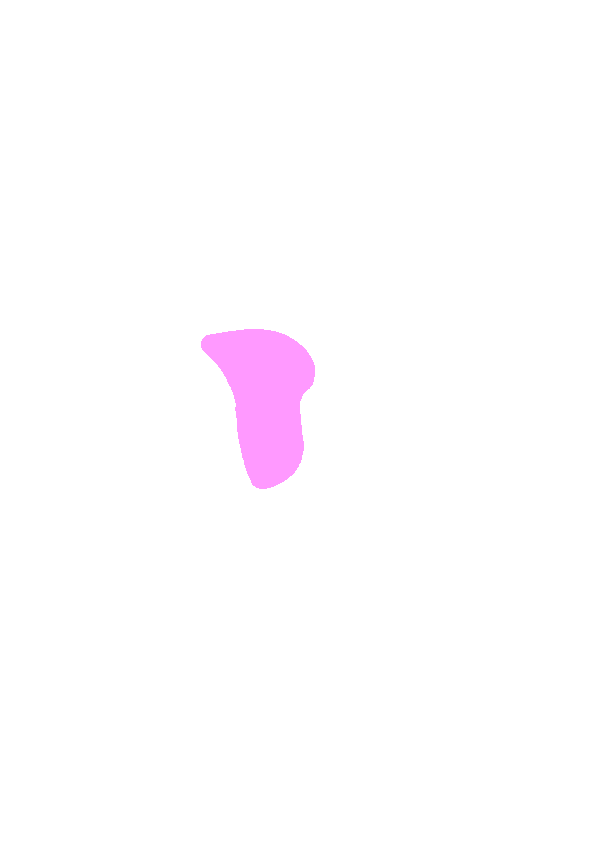 Anterior Intercondylar Area