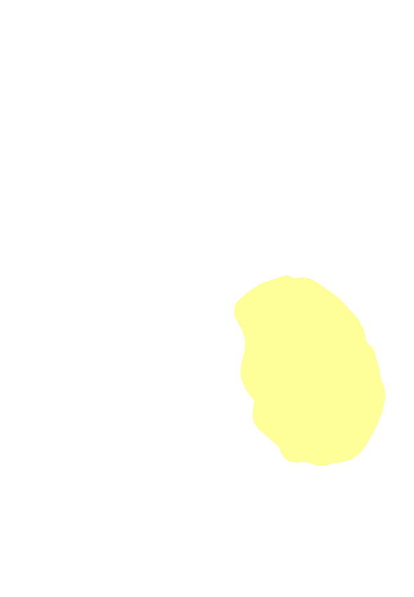 Medial Condyle Articular Surface