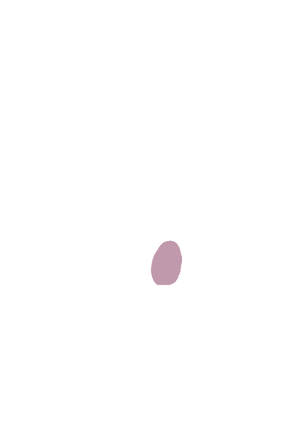 Medial Tubercle (of Eminence)