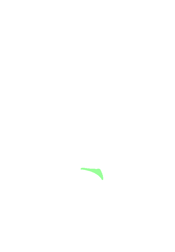Posterior Intercondylar Area