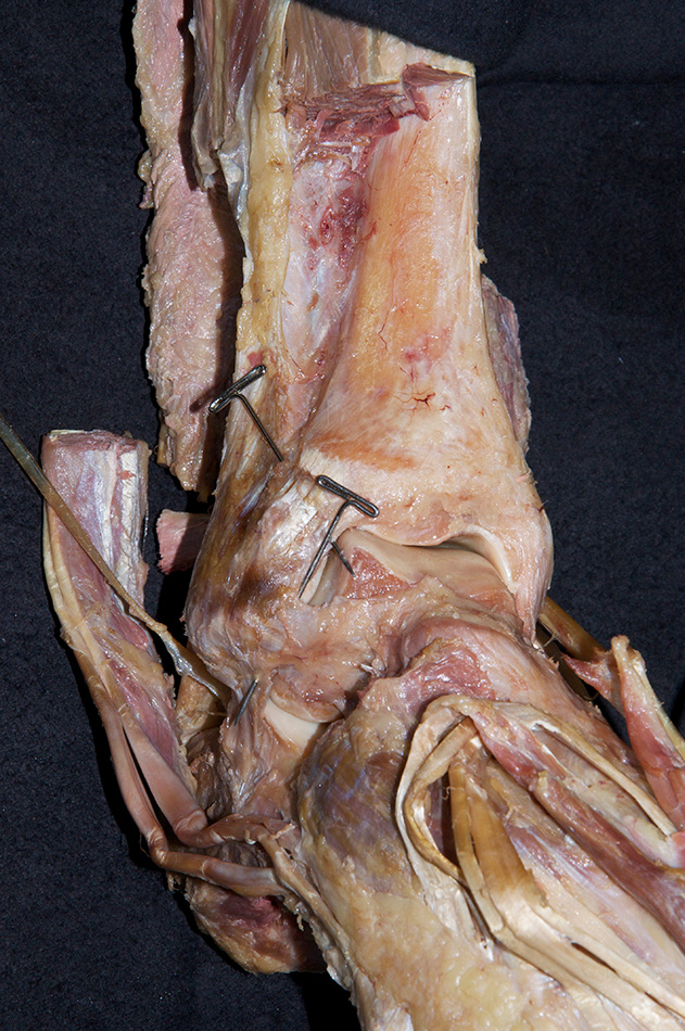Anterior Ankle