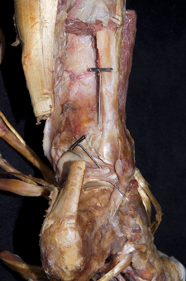 Posterior Tibiofibular Ligament