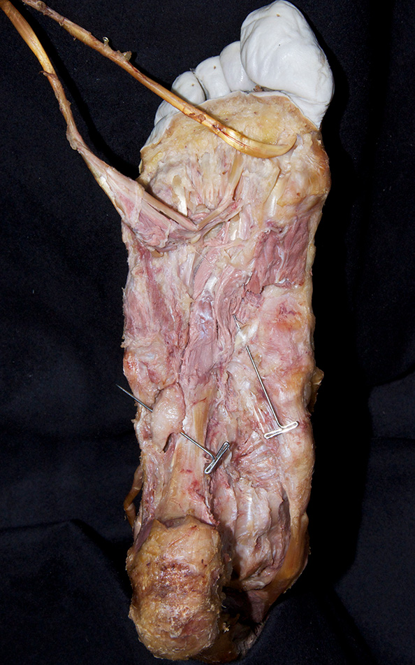 Fibularis Longus Tendon