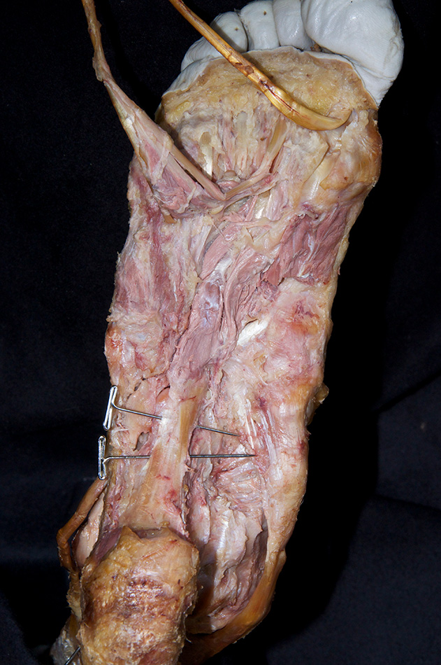 Long Plantar Ligament