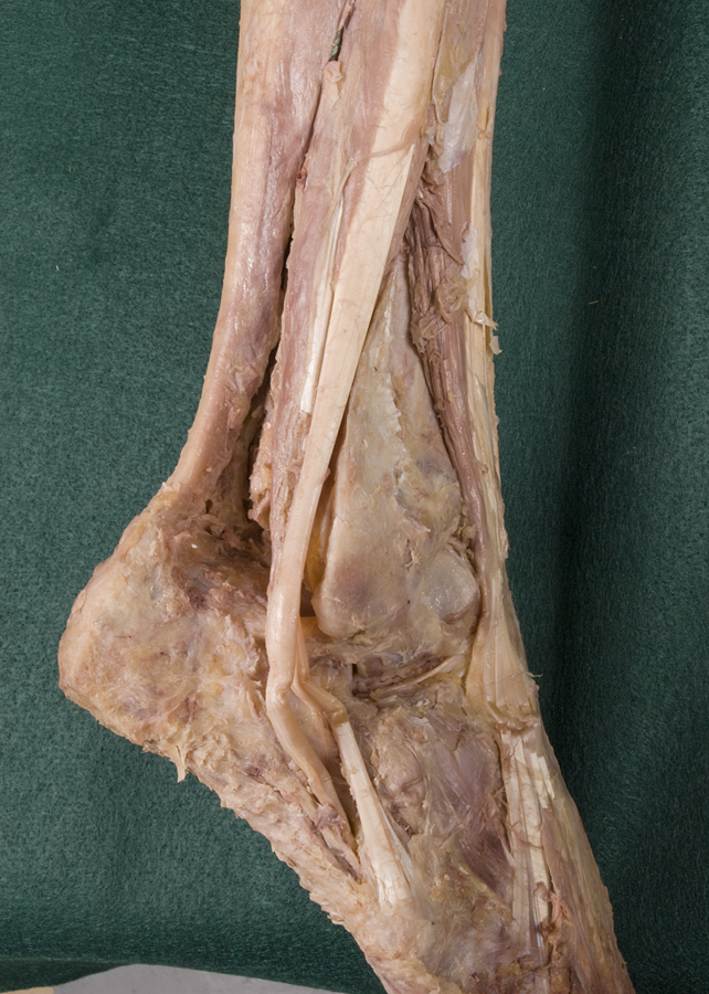 Fibularis Longus