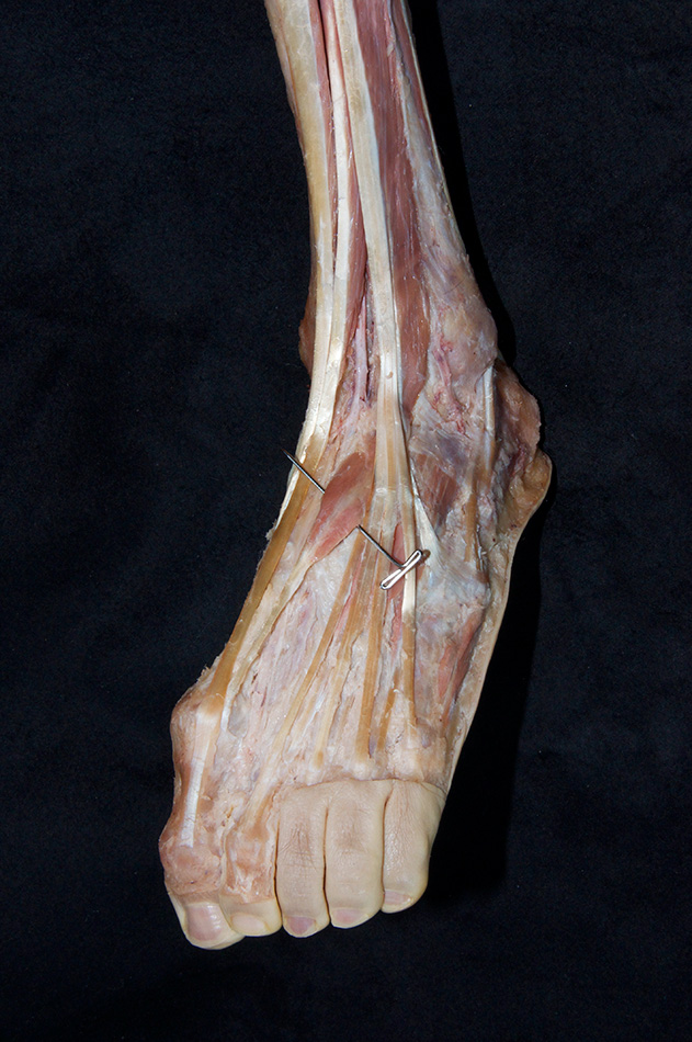Extensor Hallucis Brevis Muscle