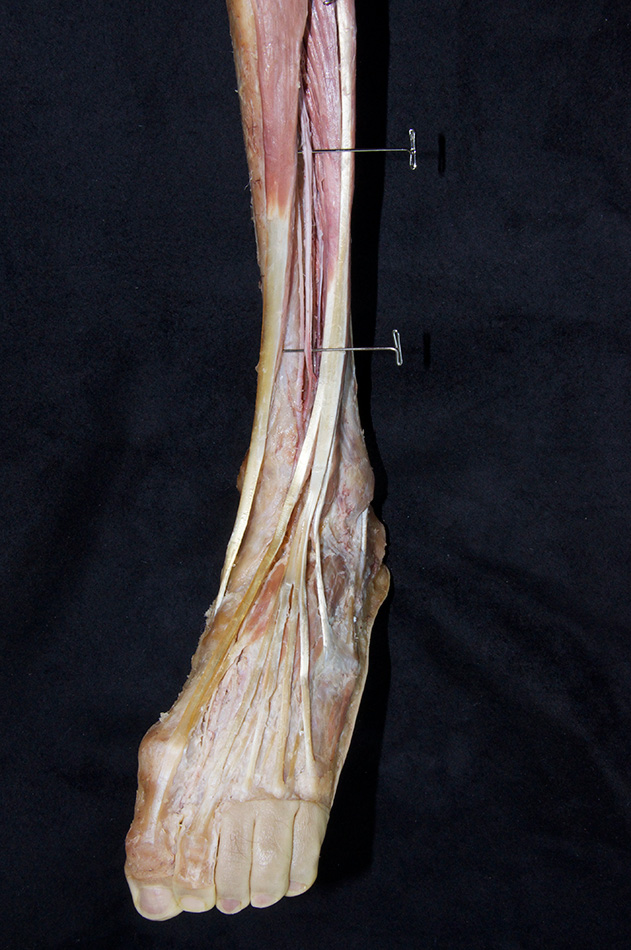Anterior Tibial Artery